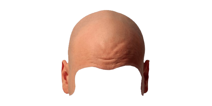 mens-bald-cap